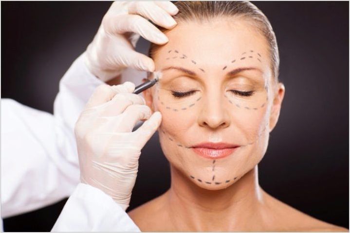Характеристики на процедурата за повдигане на ендоскопското лице