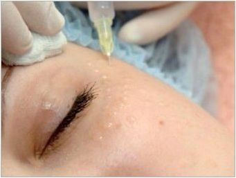 Правила за провеждане на биоревитализиране в областта на окото