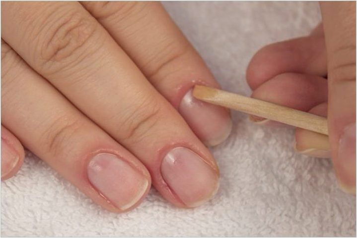 Как да премахнете лак на гел от кожата около нокътя след сушене?