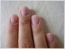Как да възстановите ноктите след гел лак?