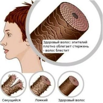 Термичната защита за изправяне на косата е гладене: видове и съвети за избор