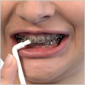 Характеристики на монопропични четки за зъби и съвети по техен избор